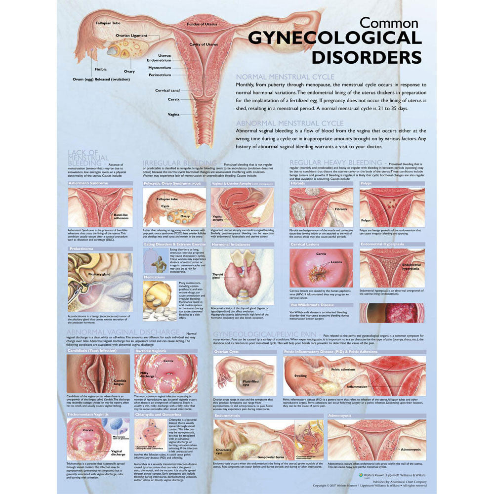 Common Gynecological Disorders Anatomical Chart