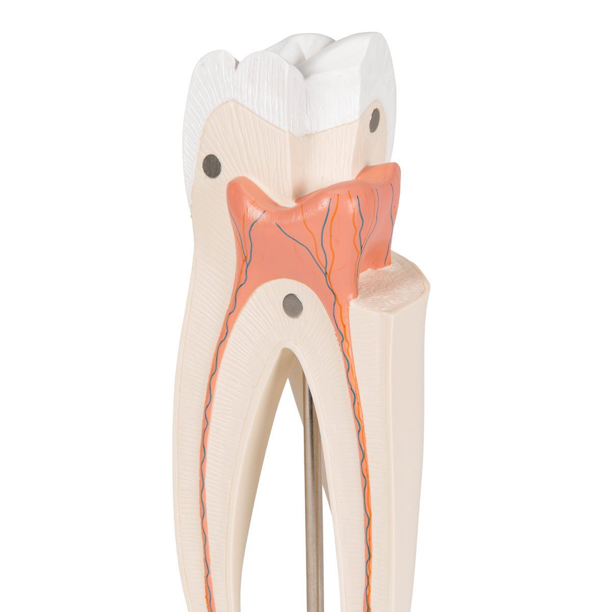 Upper Triple-Root Molar Human Tooth Model, 3 part