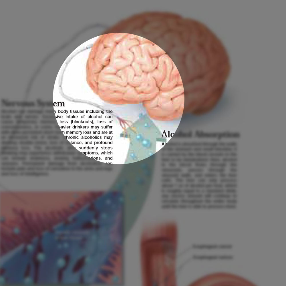 Dangers of Alcohol chart, 2E - detail