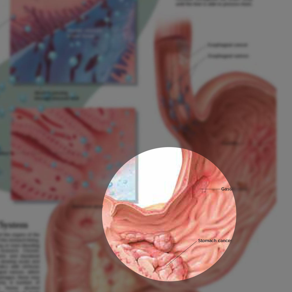 Dangers of Alcohol chart, 2E - detail