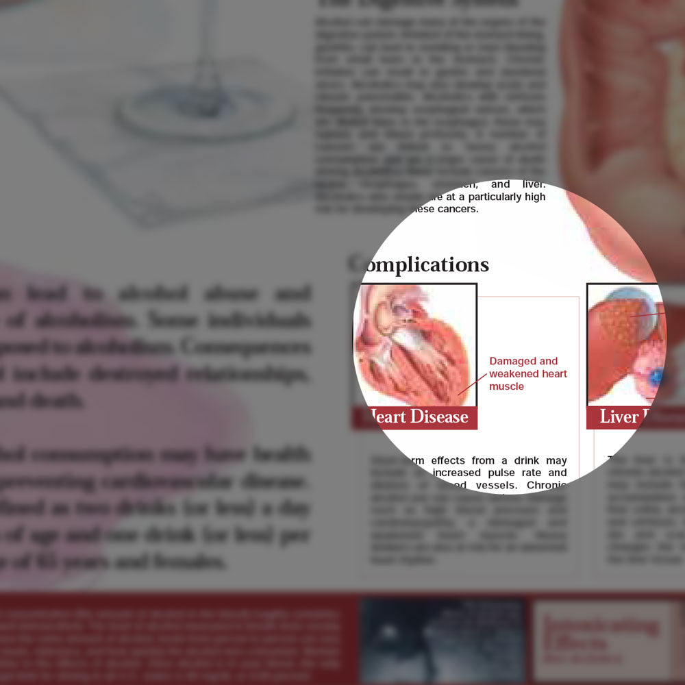 Dangers of Alcohol chart, 2E - detail