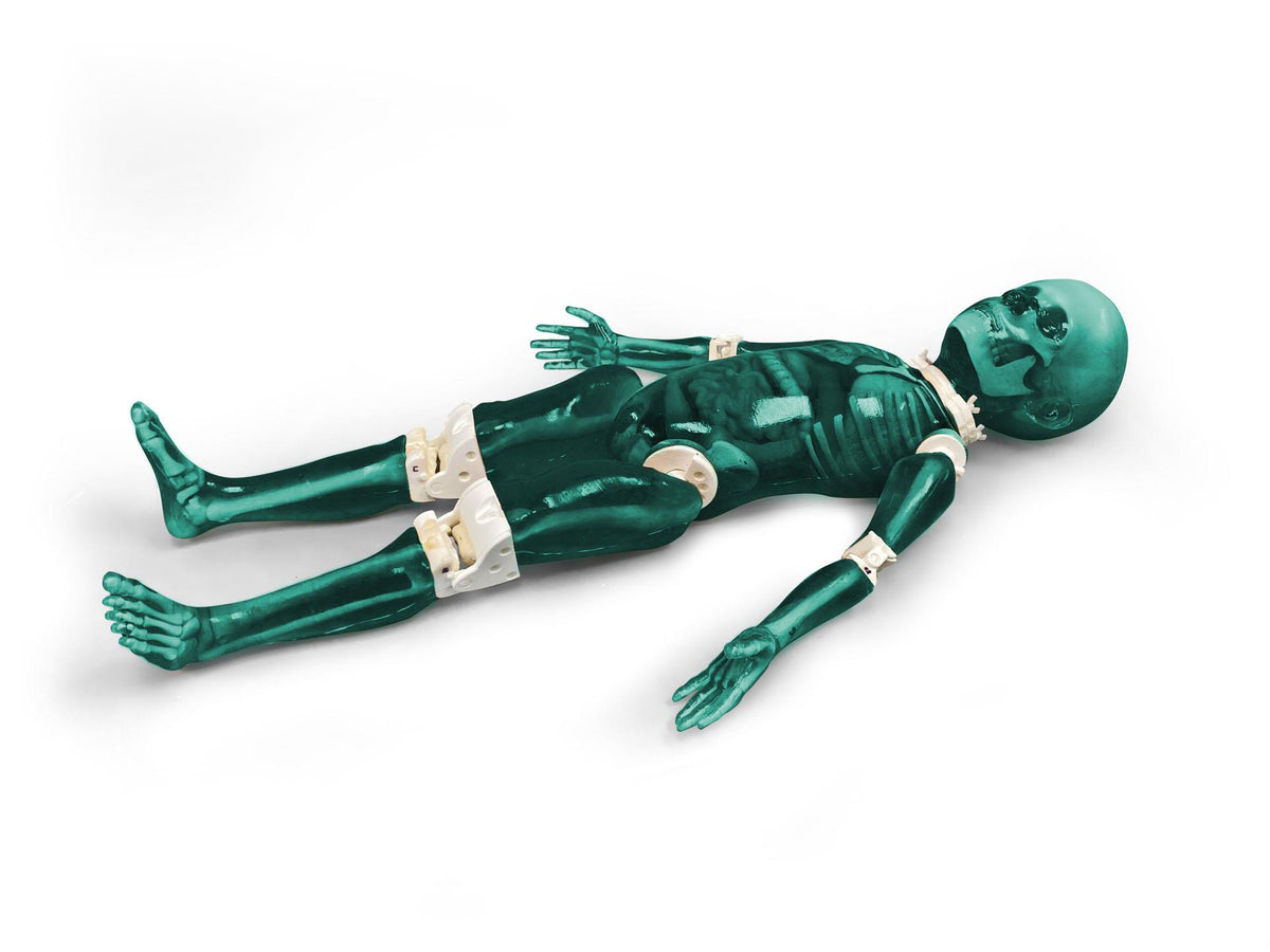 Pediatric Full Body for X-Ray CT, US - Erler-Zimmer FLP02, view 2