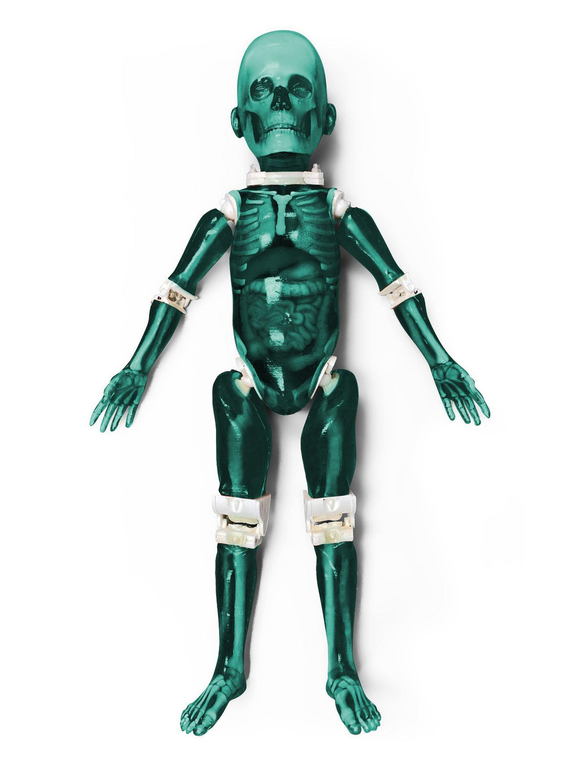 Pediatric Full Body for X-Ray CT, US - Erler-Zimmer FLP02, view 3