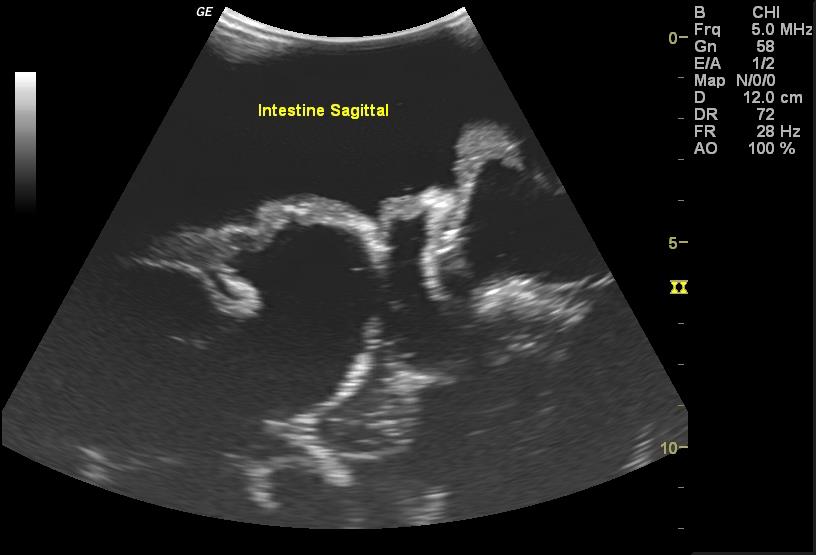 Adult Torso for X-Ray CT and US - Erler-Zimmer FLU02, view 10