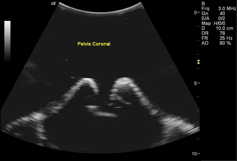 Adult Torso for X-Ray CT and US - Erler-Zimmer FLU02, view 5