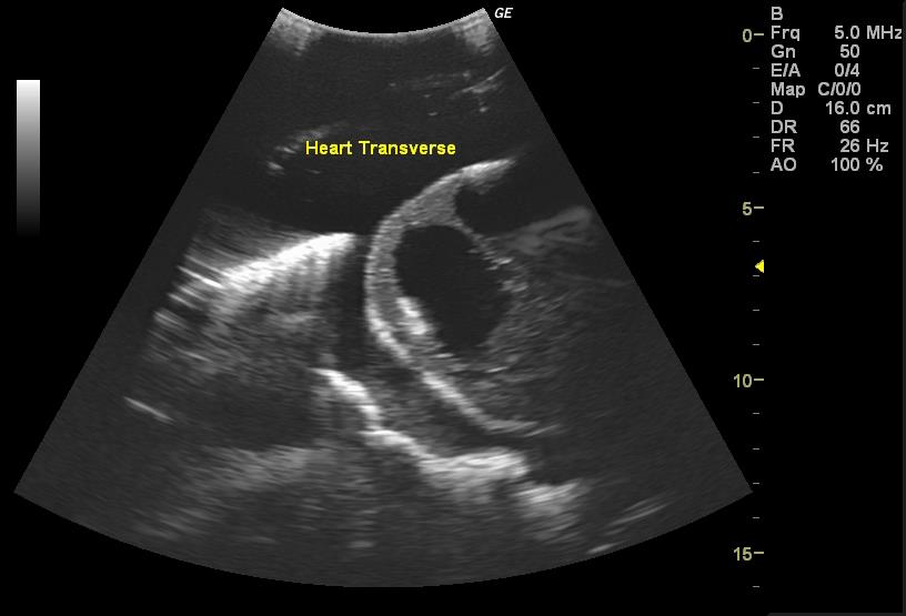 Adult Torso for X-Ray CT and US - Erler-Zimmer FLU02, view 8