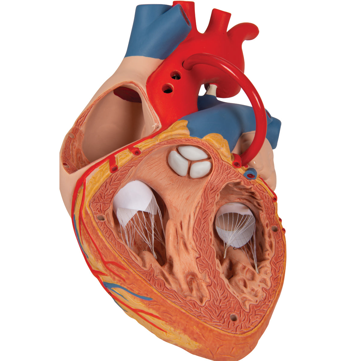 Human Heart Model with Bypass, 2 times Life-Size, 4 part - 3B Scientific G06, view 7