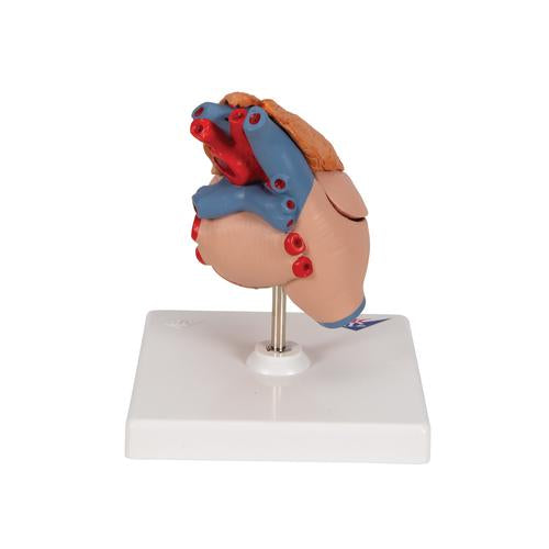 Classic Human Heart Model with Thymus, 3-Part - 3B Scientific G08/1, view 3