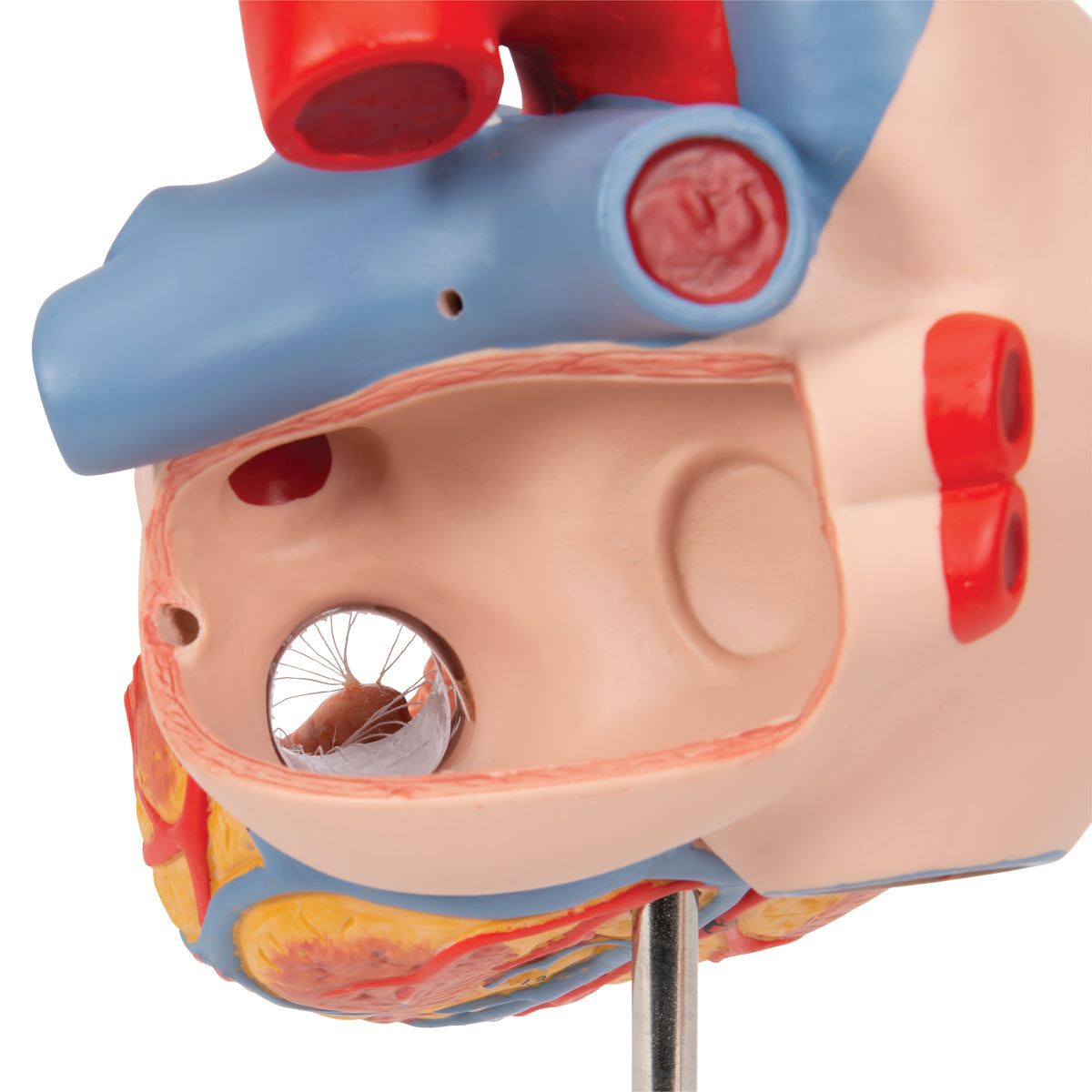 Human Heart Model with Esophagus and Trachea, 2 times Life-Size, 5 part - 3B Scientific G13, view 6