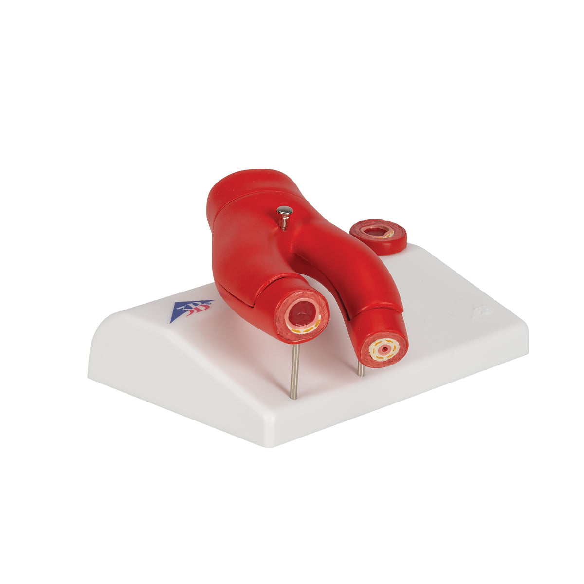 Arteriosclerosis Model, with Cross Section of Artery, 2 part - 3B Scientific G40, view 2