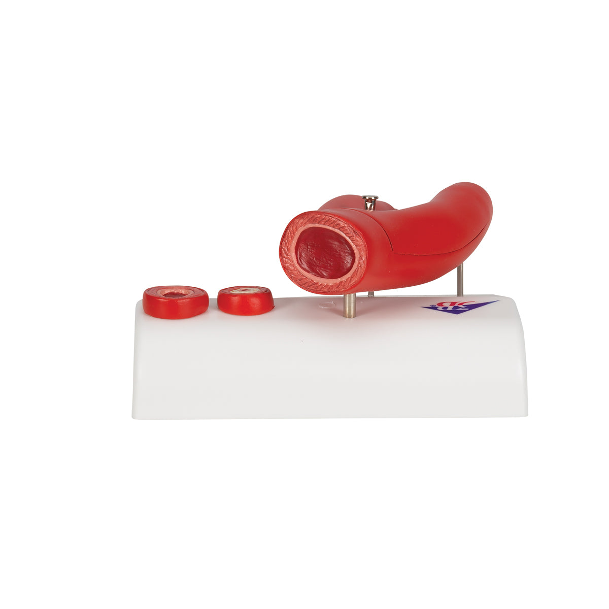 Arteriosclerosis Model, with Cross Section of Artery, 2 part - 3B Scientific G40, view 4