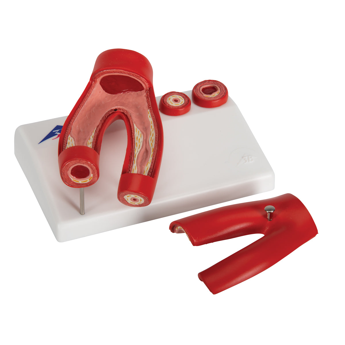 Arteriosclerosis Model, with Cross Section of Artery, 2 part - 3B Scientific G40, view 7