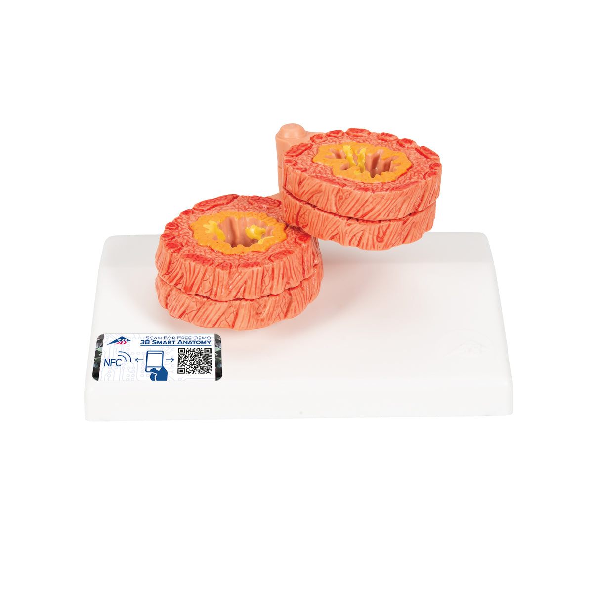 COPD Bronchial Tissue Model
