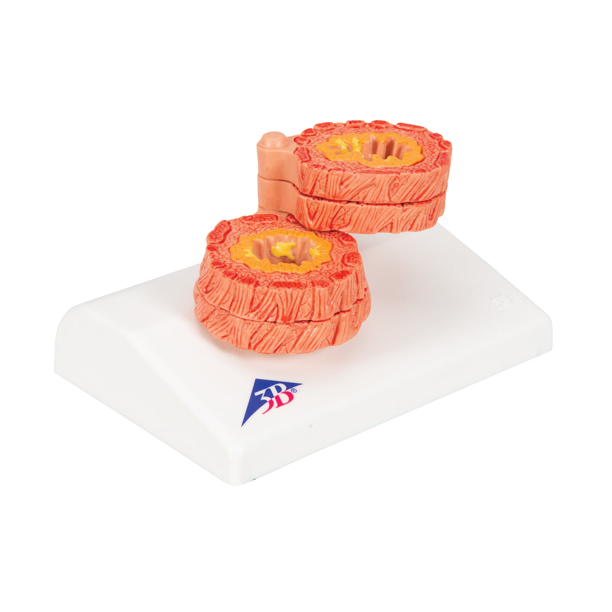 COPD Bronchial Tissue Model