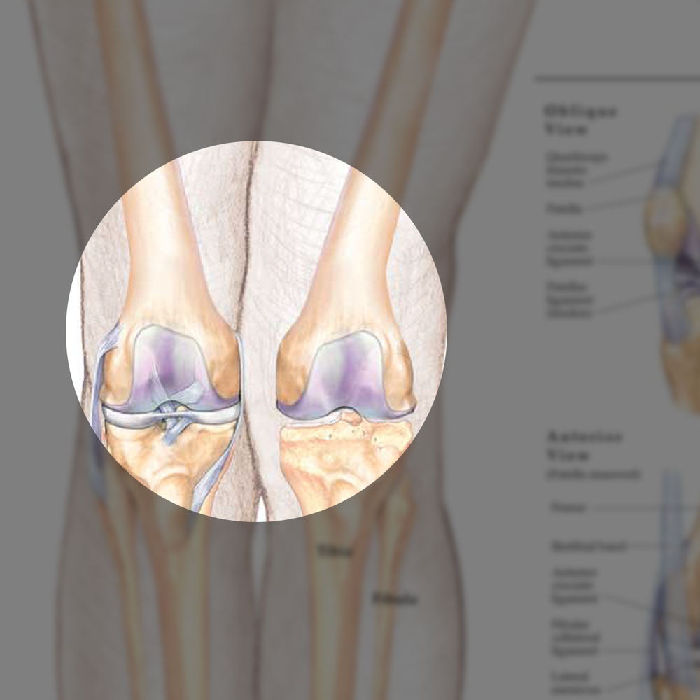 Hip & Knee - highlight