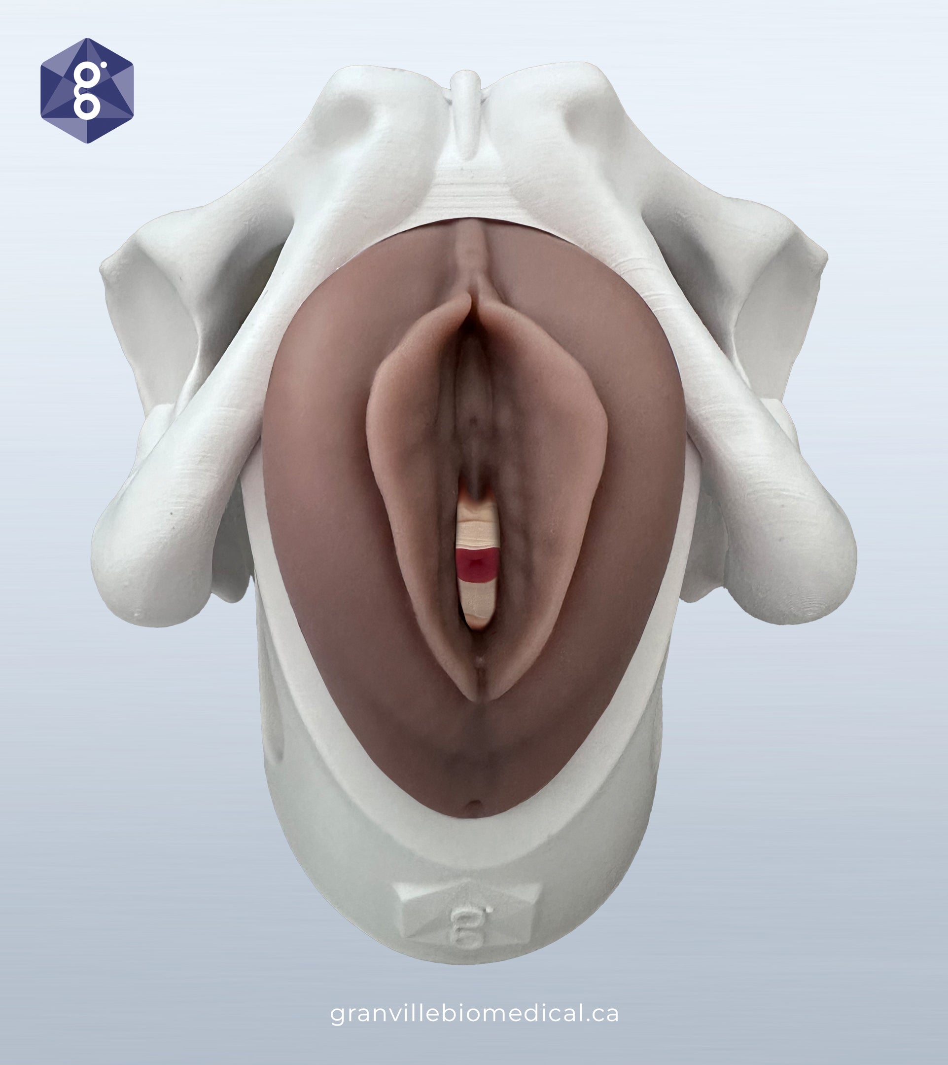 Iris pessary demonstration model in medium skin tone