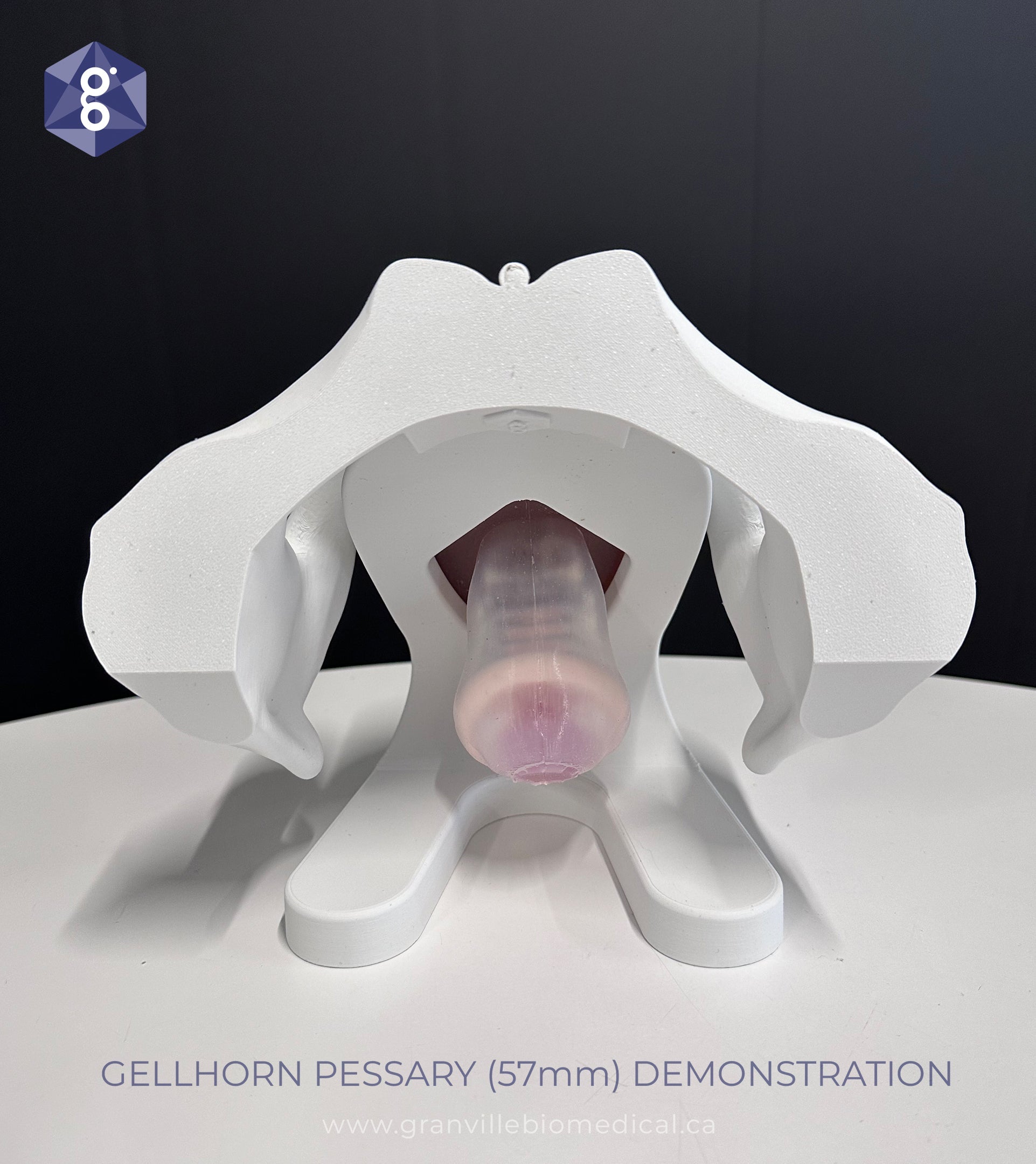 Iris model demonstrating Gellhorn pessary fitting