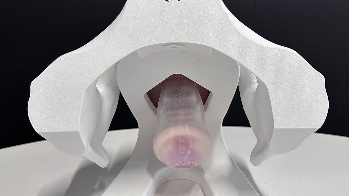 Iris model demonstrating Gellhorn pessary fitting