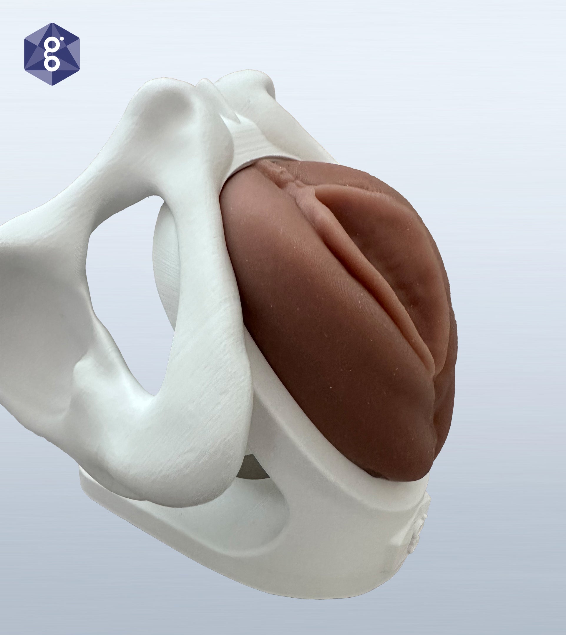 Iris pessary demonstration model, side view