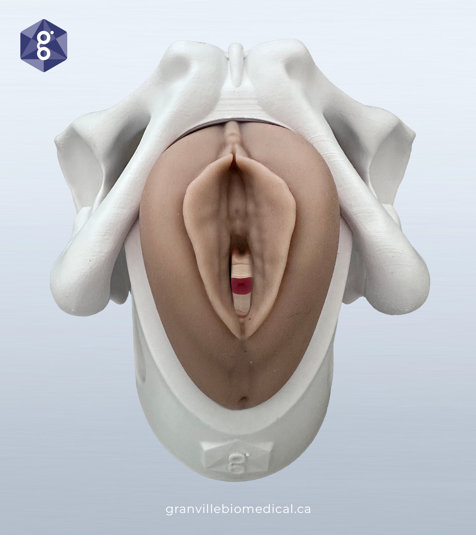Iris pessary demonstration model in light skin tone