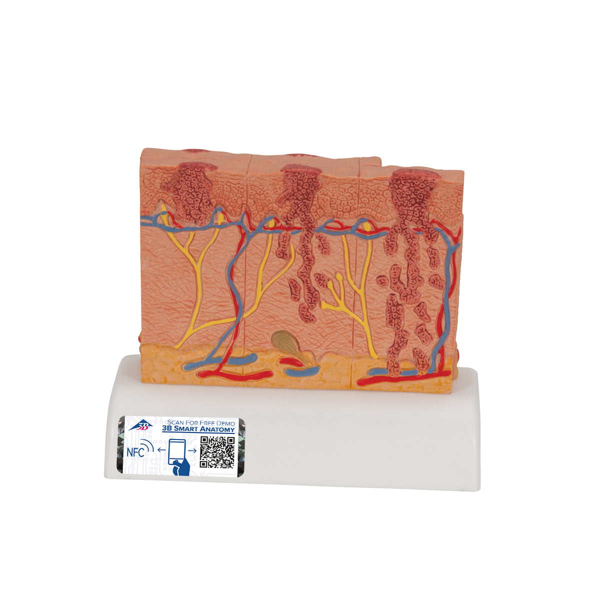 Skin Cancer Model with 5 stages, 8 times magnified