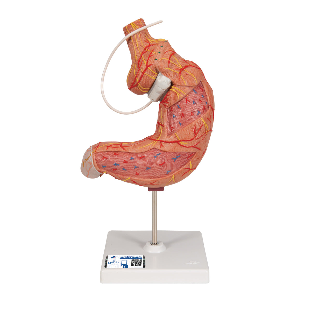 Human Stomach Model with Gastric Band, 2 part