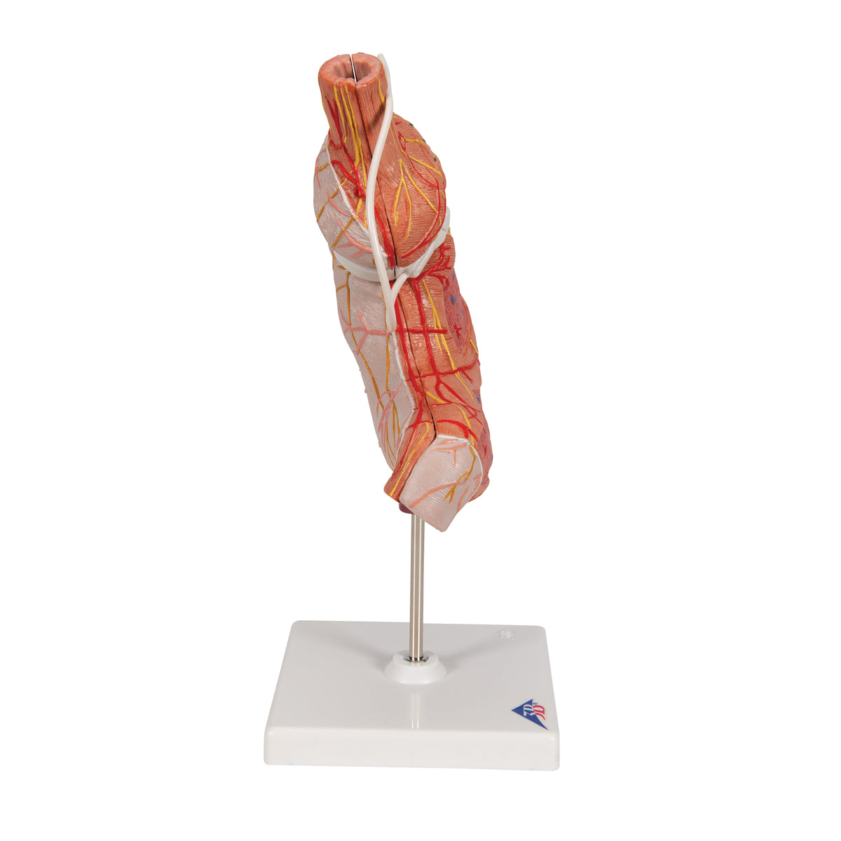 Human Stomach Model with Gastric Band, 2 part