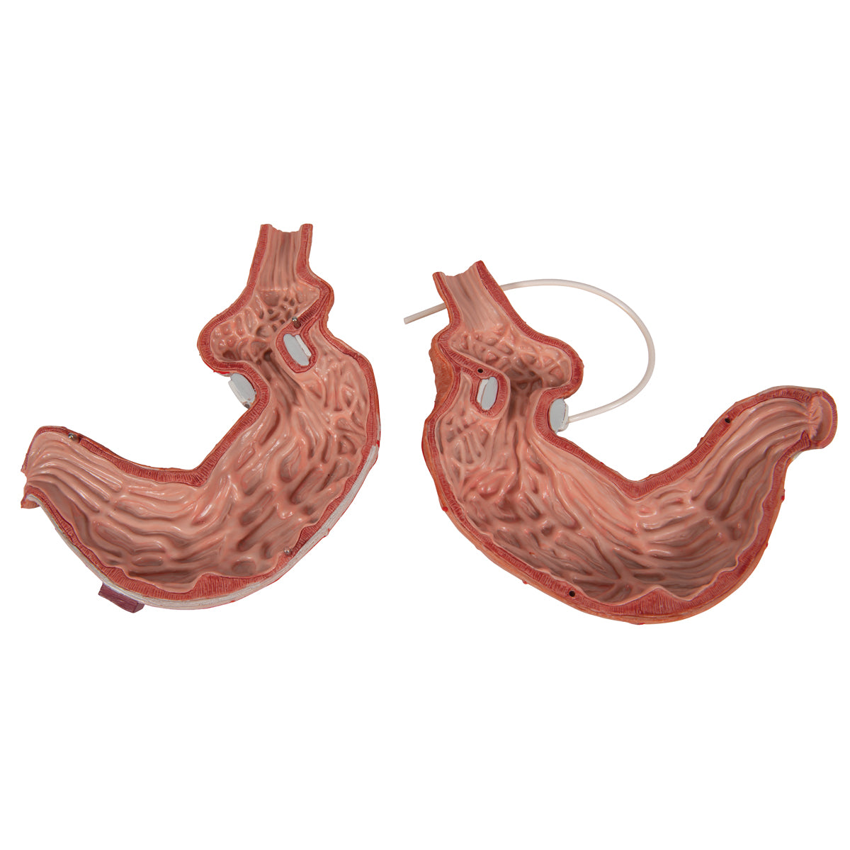 Human Stomach Model with Gastric Band, 2 part