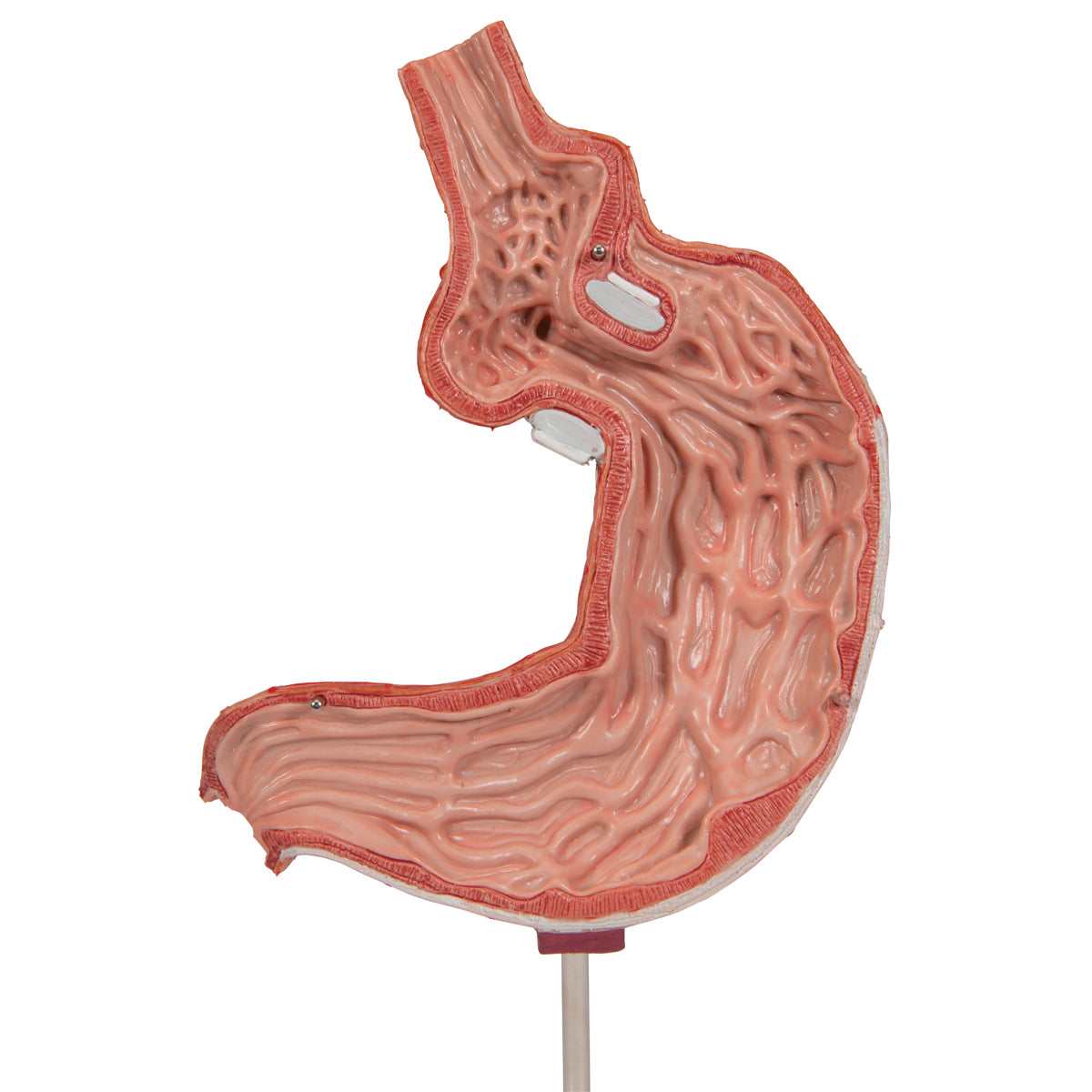 Human Stomach Model with Gastric Band, 2 part