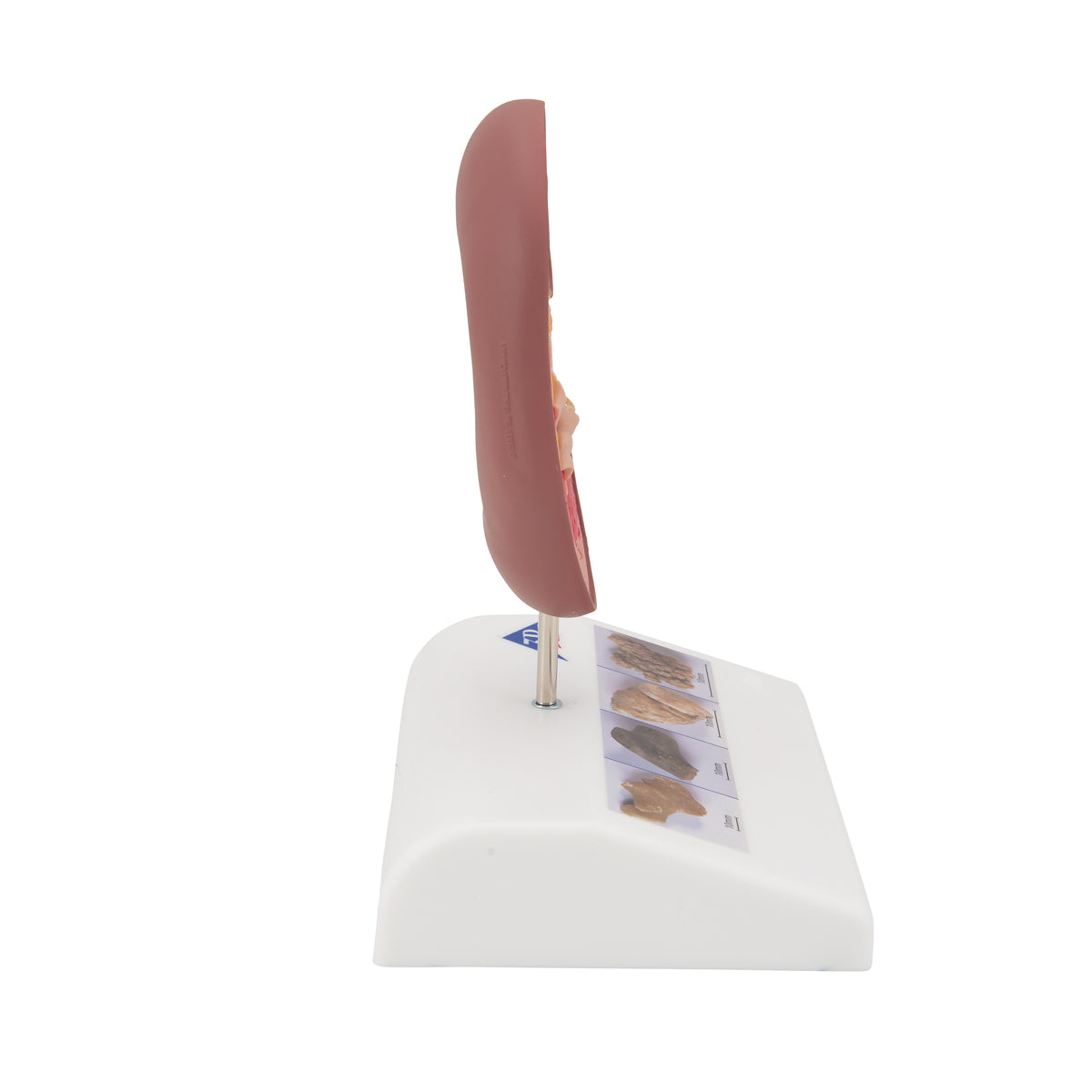 Kidney Stone Model - 3B Scientific K29, view 10