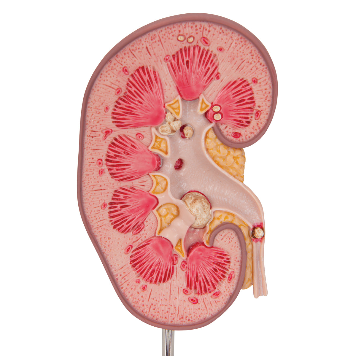 Kidney Stone Model - 3B Scientific K29, view 14