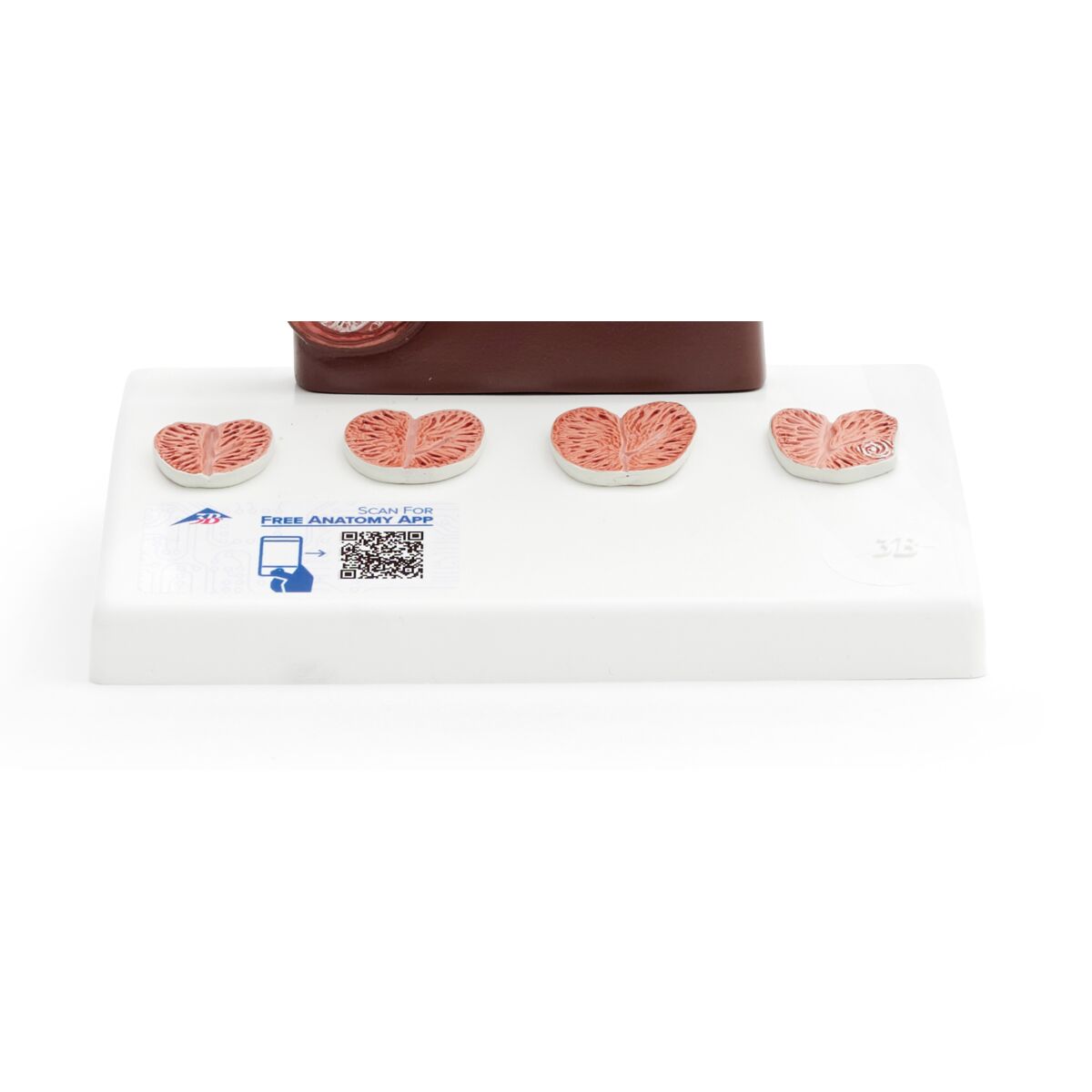 Prostate Model, 1/2 Natural Size, dark skin