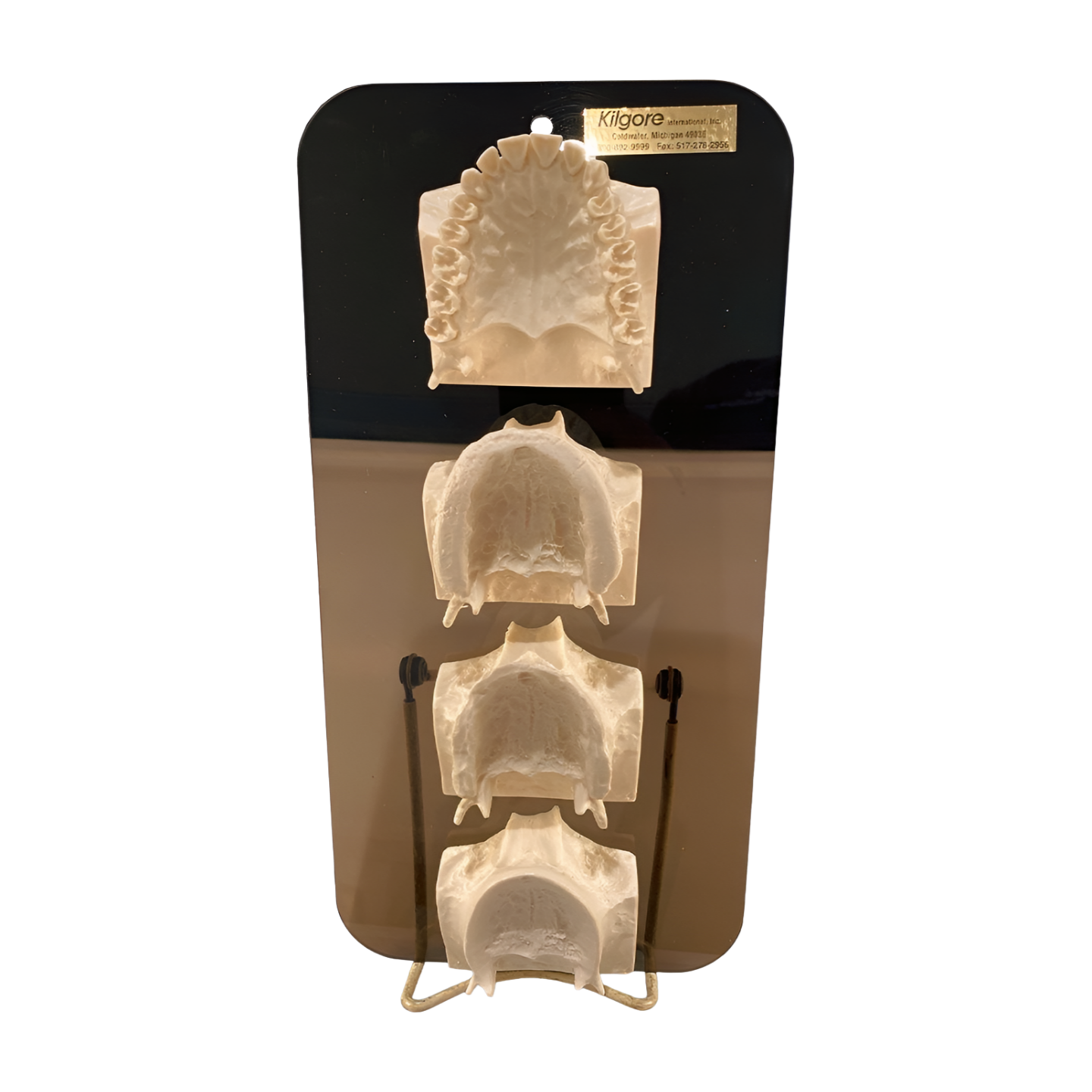 KI-G4UM – Edentulous Maxillae Series