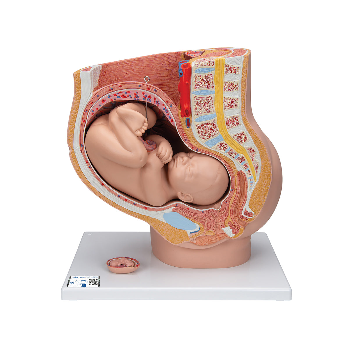 Pregnancy Pelvis Model in Median Section with Removable Fetus (40 weeks), 3 part - 3B Scientific L20