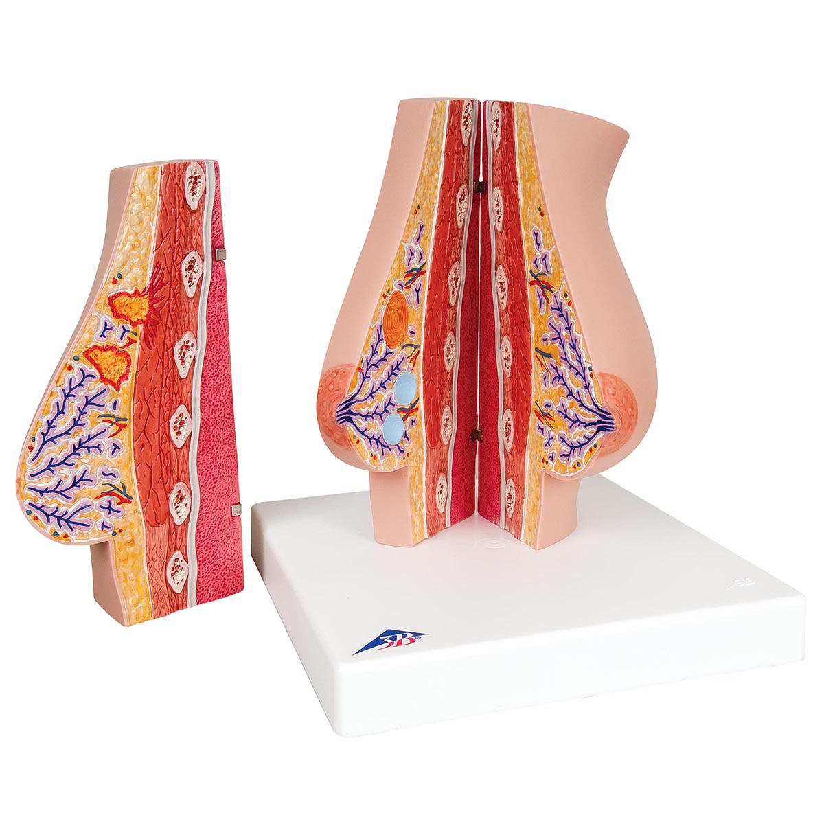 Model of Female Breast with Healthy & Unhealthy Tissue