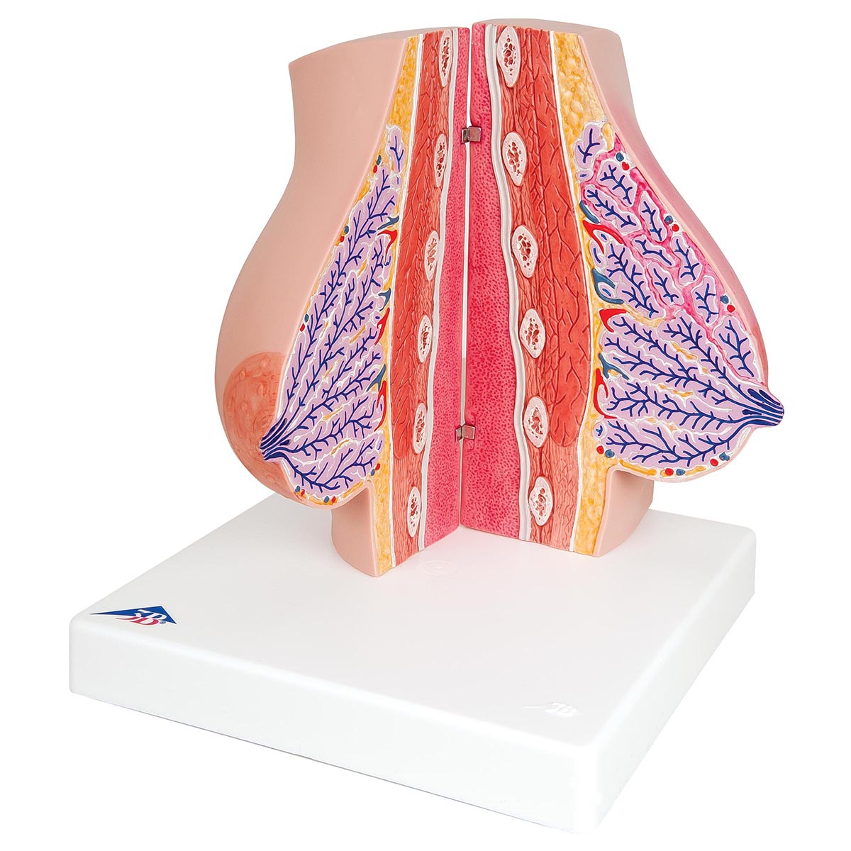 Model of Female Breast with Healthy & Unhealthy Tissue