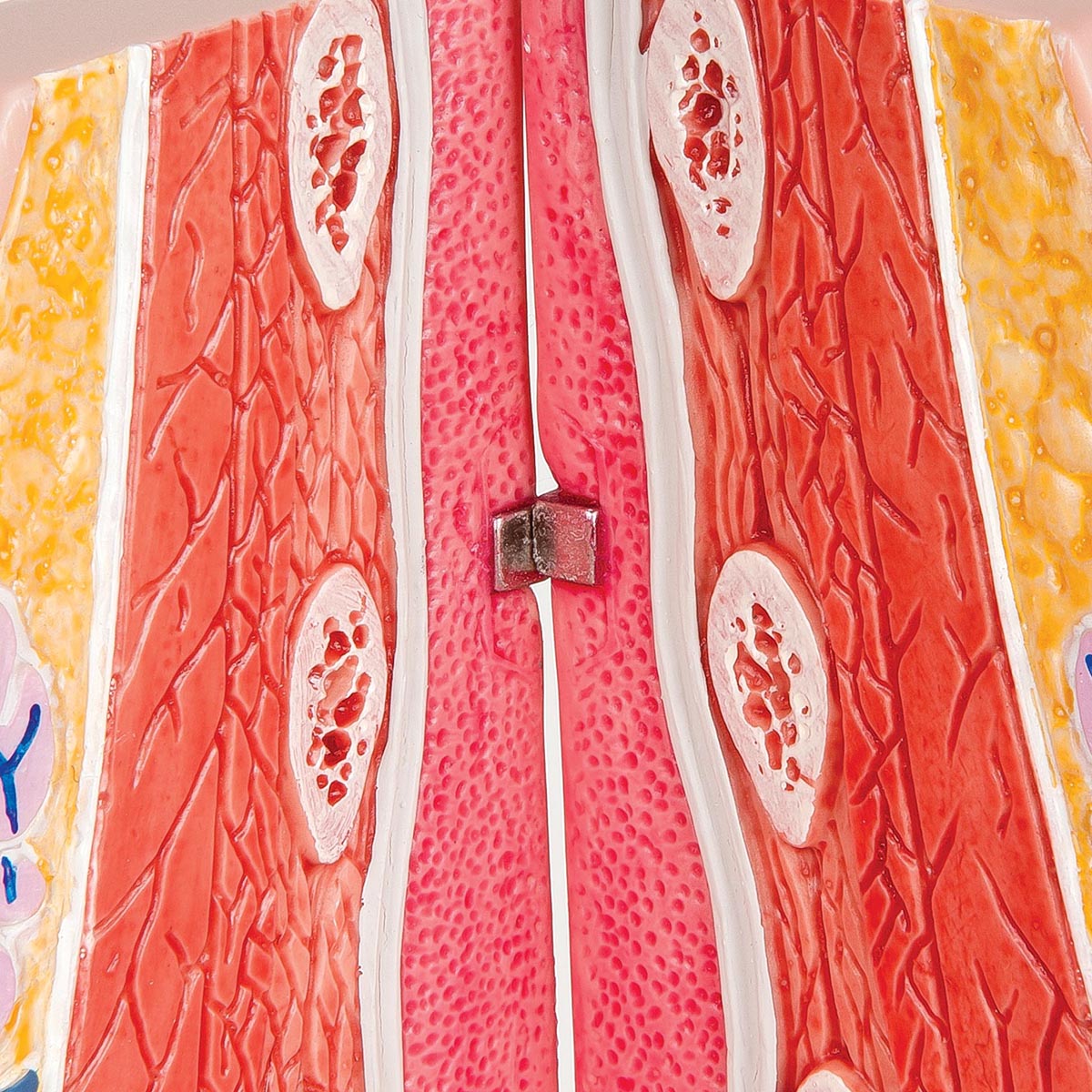 Model of Female Breast with Healthy & Unhealthy Tissue