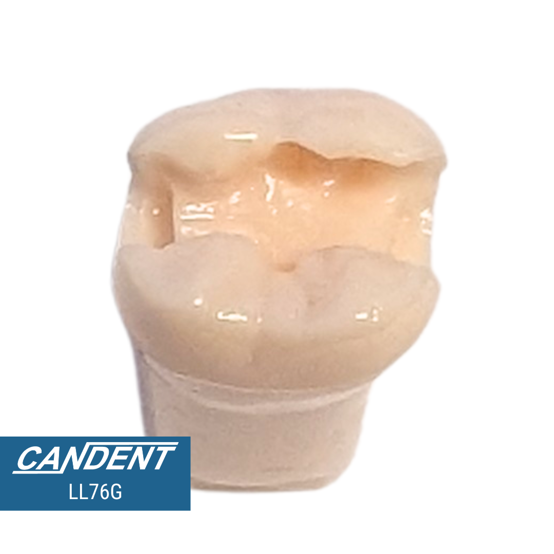 200 Series Pre-prepared Teeth