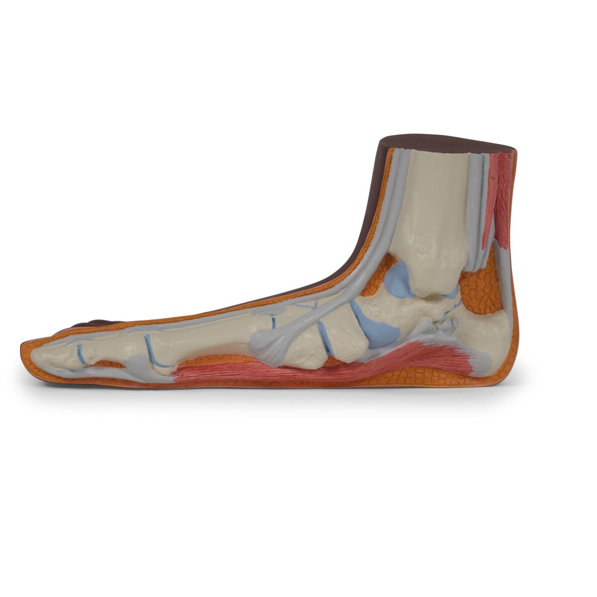 Flat Foot (Pes Planus) Model, dark skin