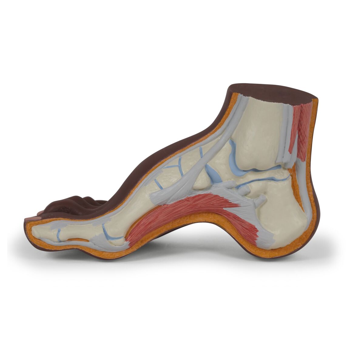 Hollow Foot (Pes Cavus) Model, dark skin