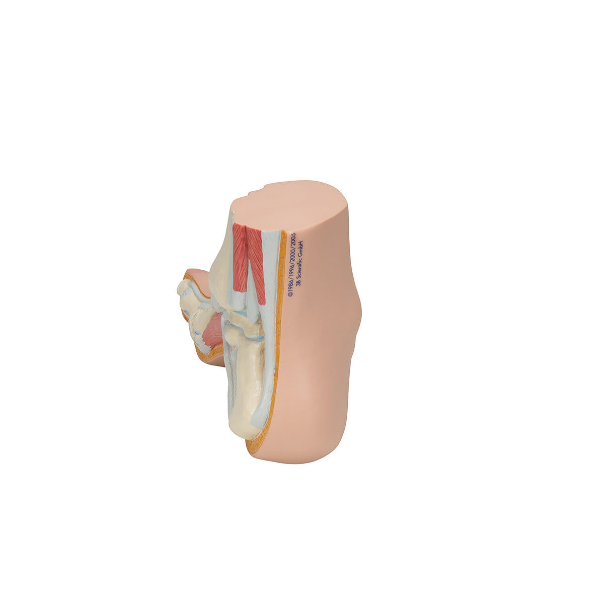 Hollow Foot (Pes Cavus) Model - 3B Scientific M32, view 11