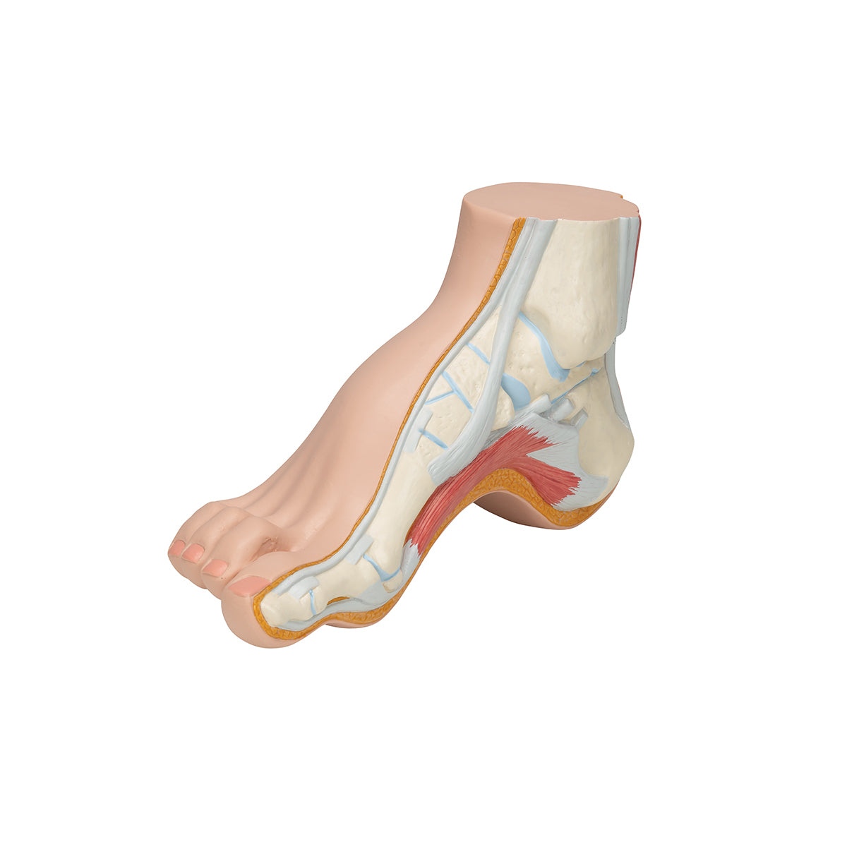 Hollow Foot (Pes Cavus) Model - 3B Scientific M32, view 13