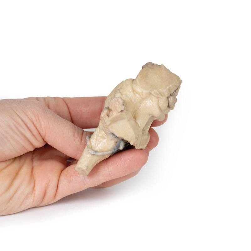 Brain Stem, isolated anatomy from midbrain to medulla oblongata 3D Replica MP1101 | Erler-Zimmer | Candent