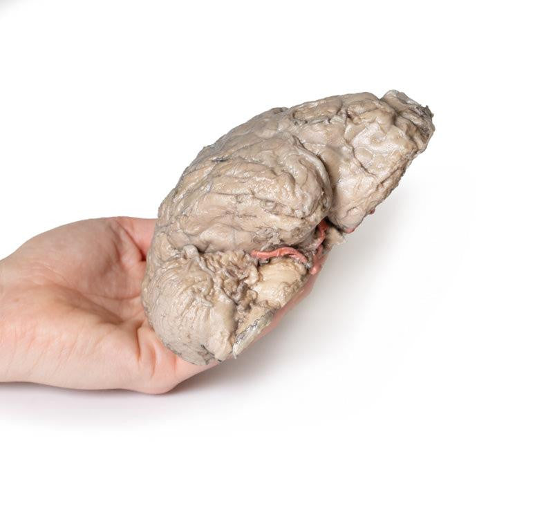 Brain Hemisection 3D Replica MP1102 | Erler-Zimmer | Candent 2