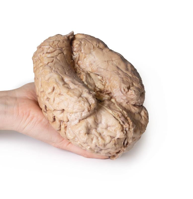 Brain (Cerebrum) 3D Replica MP1103 | Erler-Zimmer | Candent 3
