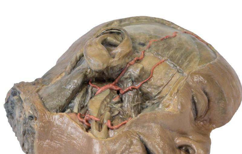 Sagittal Section of head with infratemporal Fossa Dissection 3D Replica MP1104 | Erler-Zimmer | Candent 4