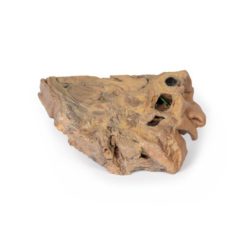 Sinus Pathways 3D Replica MP1106 | Erler-Zimmer | Candent 3