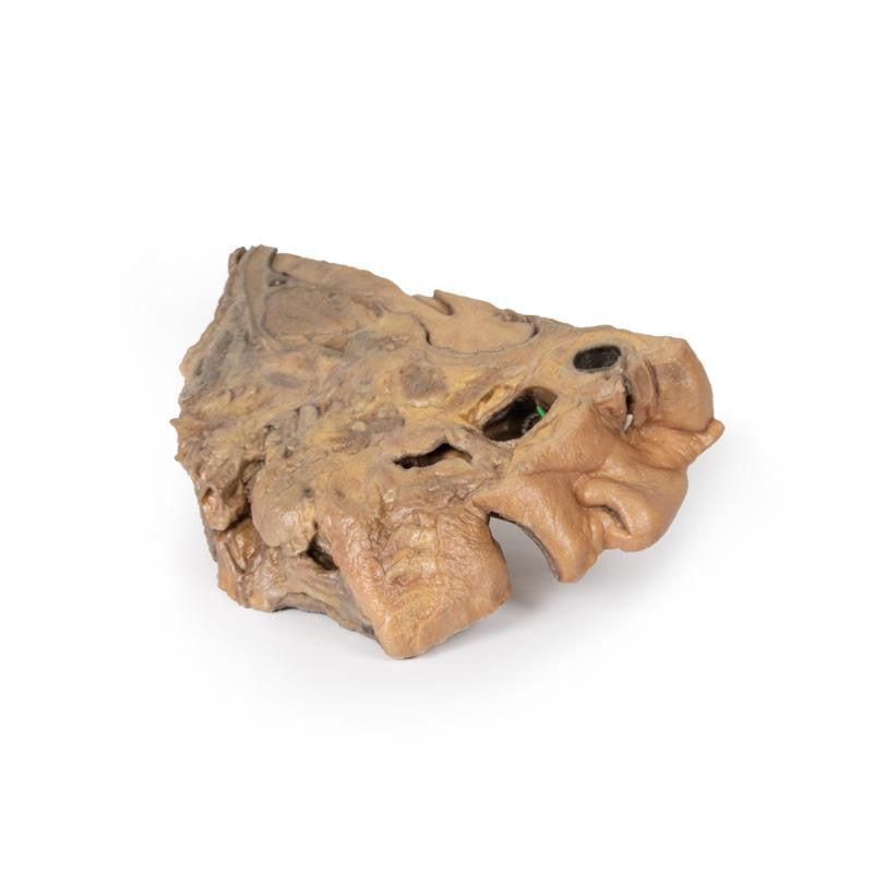 Sinus Pathways 3D Replica MP1106 | Erler-Zimmer | Candent 4