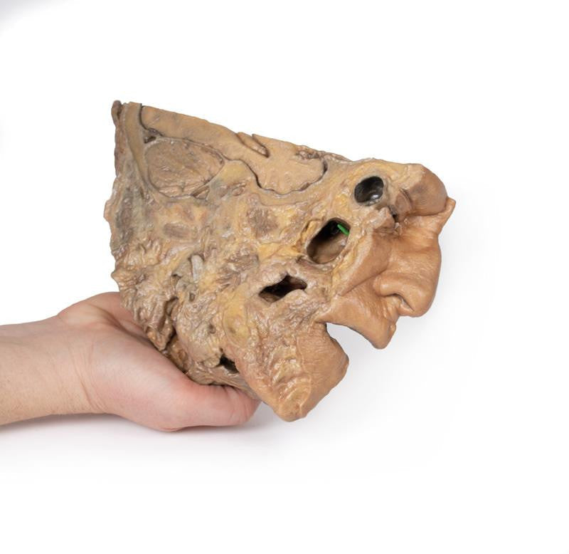 Sinus Pathways 3D Replica MP1106 | Erler-Zimmer | Candent