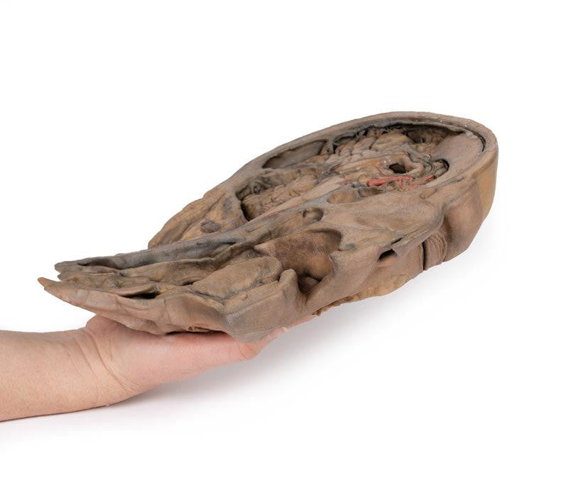 Parasagittal Section of the head and neck 3D Replica MP1107 | Erler-Zimmer | Candent 3